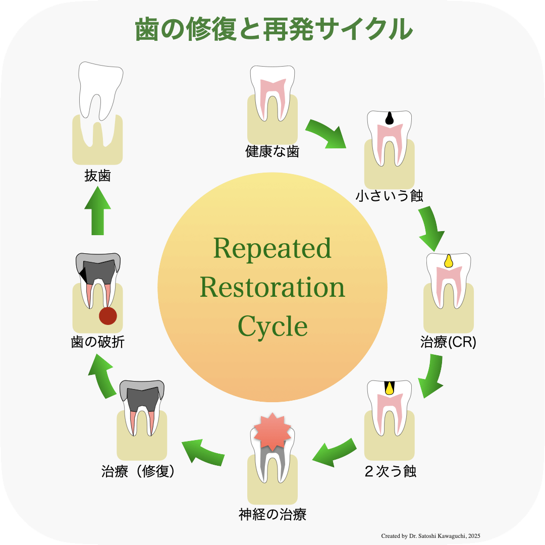 歯の修復と再発サイクルの図