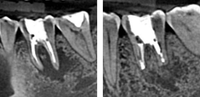 レントゲン写真