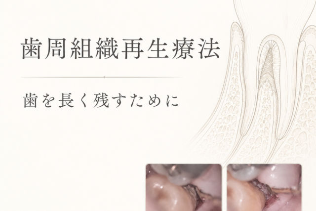 歯周組織再生療法の長期予後とデブライドメントを解説するアイキャッチ画像